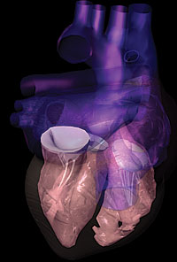 3D heart image